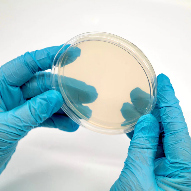 A petri dish with a beige colored agar gel inside being examined from the point of view of someone wearing blue nitrile gloves.